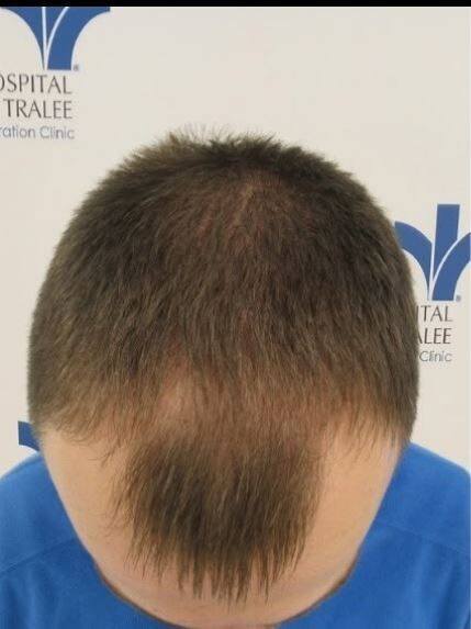 Before Proven results