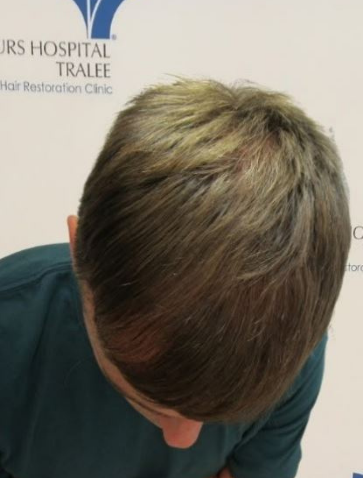 After Proven results