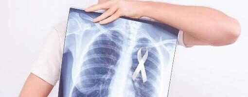Lung cancer